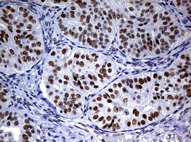 NBN Antibody in Immunohistochemistry (Paraffin) (IHC (P))