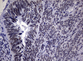 NBN Antibody in Immunohistochemistry (Paraffin) (IHC (P))