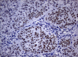 NBN Antibody in Immunohistochemistry (Paraffin) (IHC (P))