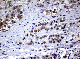 NBN Antibody in Immunohistochemistry (Paraffin) (IHC (P))