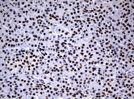 NBN Antibody in Immunohistochemistry (Paraffin) (IHC (P))