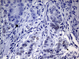 NBN Antibody in Immunohistochemistry (Paraffin) (IHC (P))