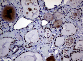 NBN Antibody in Immunohistochemistry (Paraffin) (IHC (P))