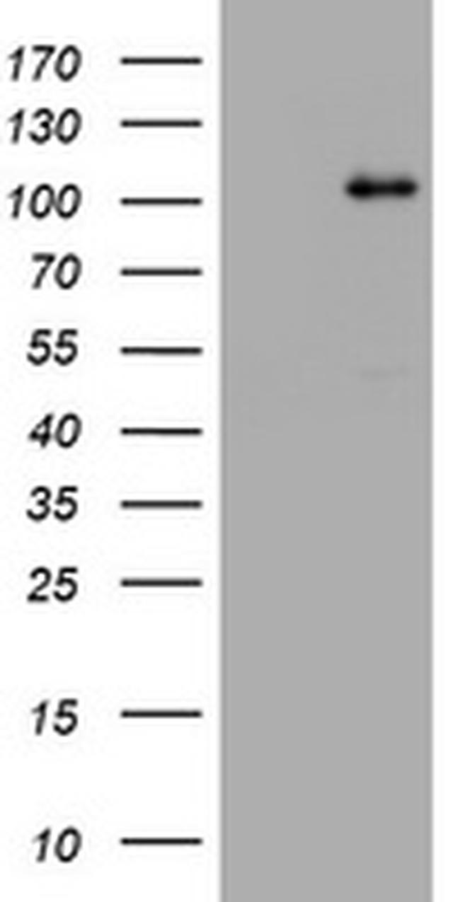 NBN Antibody in Western Blot (WB)