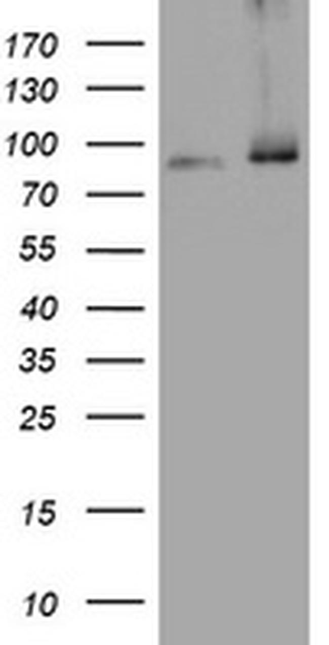 NBN Antibody in Western Blot (WB)