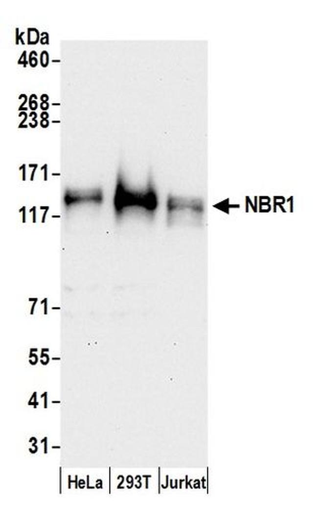 NBR1 Antibody in Western Blot (WB)