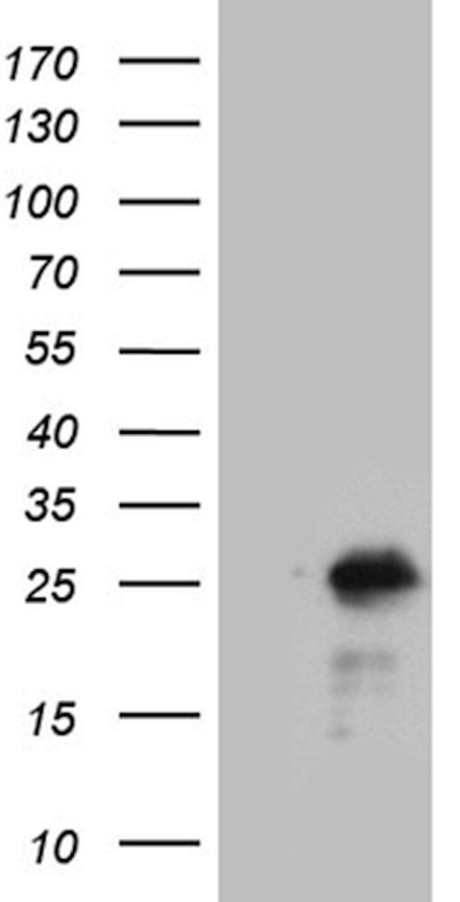 NCALD Antibody in Western Blot (WB)