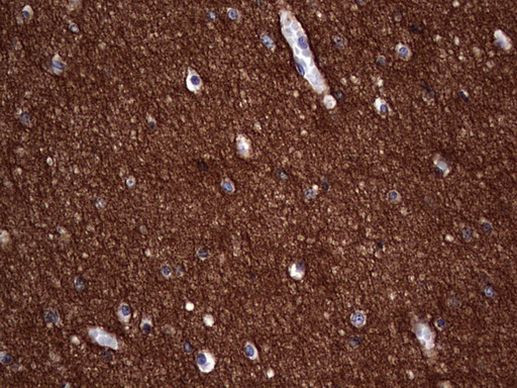 NCAM1 Antibody in Immunohistochemistry (Paraffin) (IHC (P))