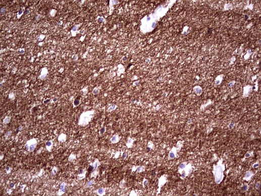 NCAM1 Antibody in Immunohistochemistry (Paraffin) (IHC (P))