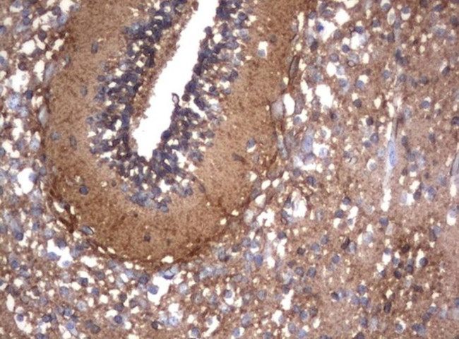 NCAM1 Antibody in Immunohistochemistry (Paraffin) (IHC (P))