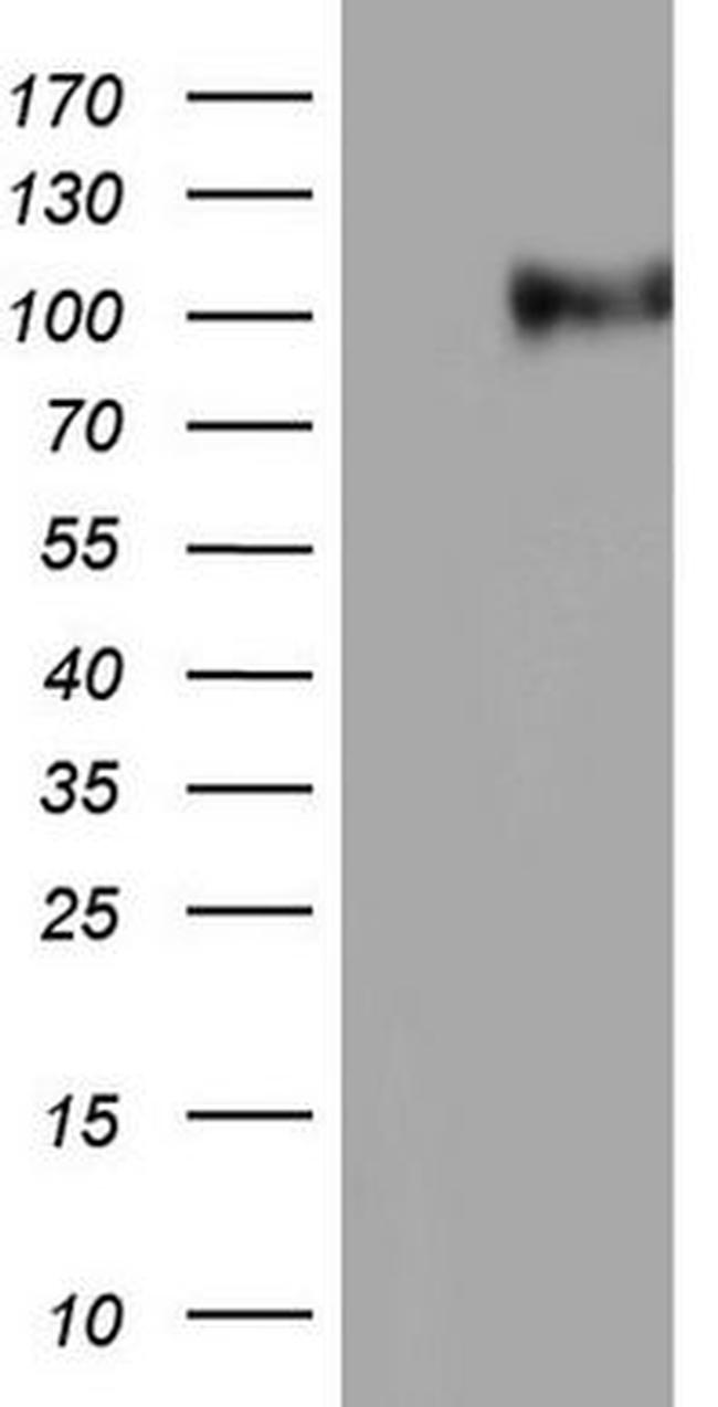 NCAM1 Antibody in Western Blot (WB)