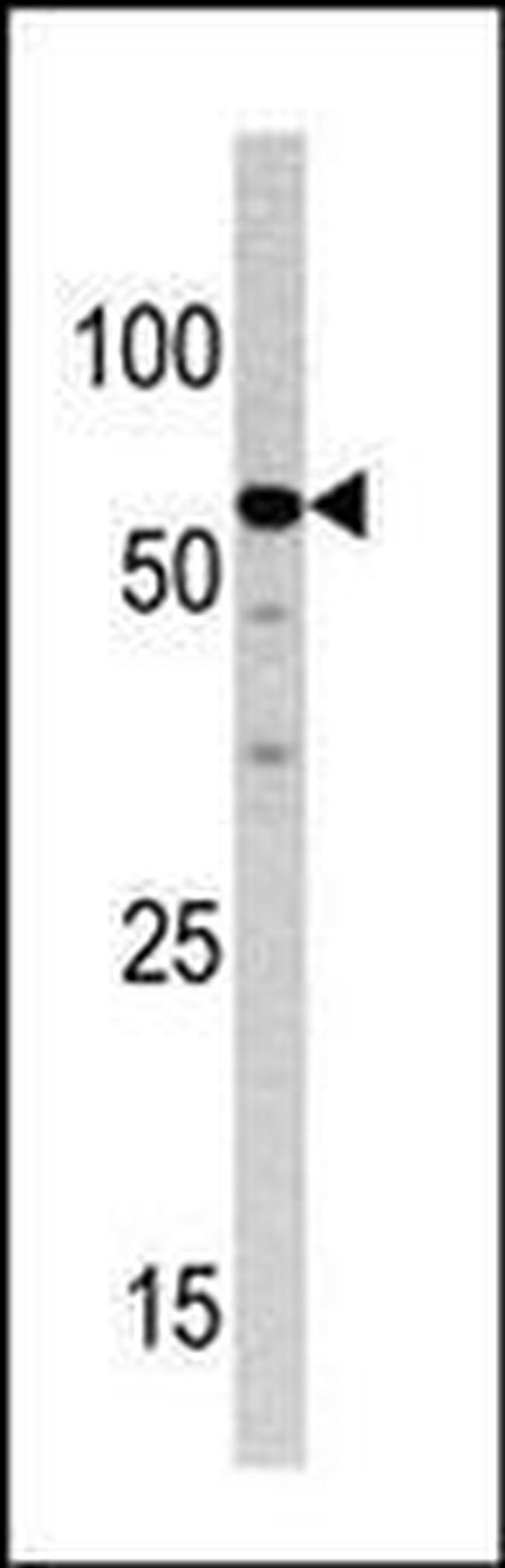 NCAPH2 Antibody in Western Blot (WB)