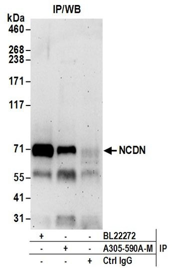 NCDN Antibody in Immunoprecipitation (IP)