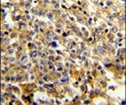 NCF4 Antibody in Immunohistochemistry (IHC)