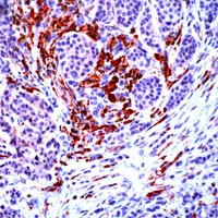 NCK2 Antibody in Immunohistochemistry (IHC)