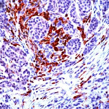 NCK2 Antibody in Immunohistochemistry (IHC)