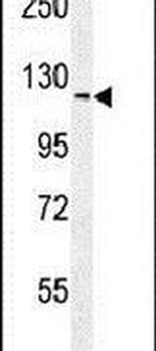 NCKAP1 Antibody in Western Blot (WB)