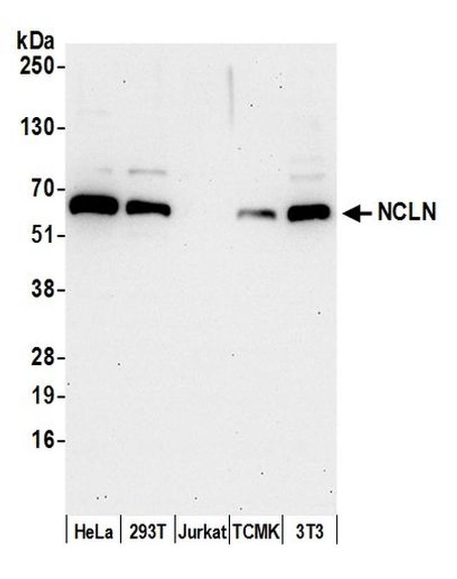 NCLN Antibody in Western Blot (WB)