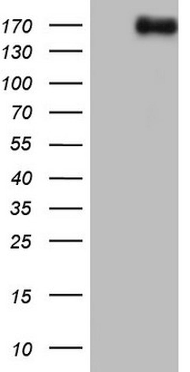 NCOA2 Antibody in Western Blot (WB)
