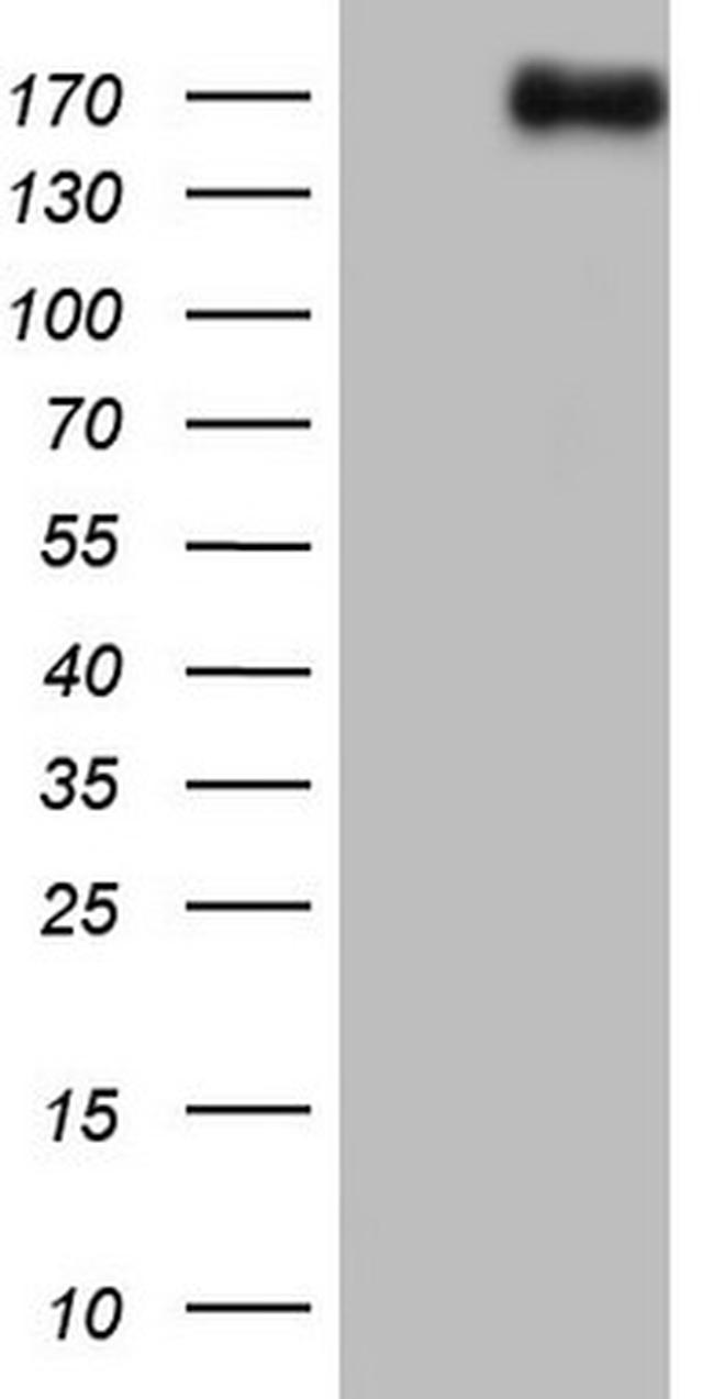 NCOA2 Antibody in Western Blot (WB)