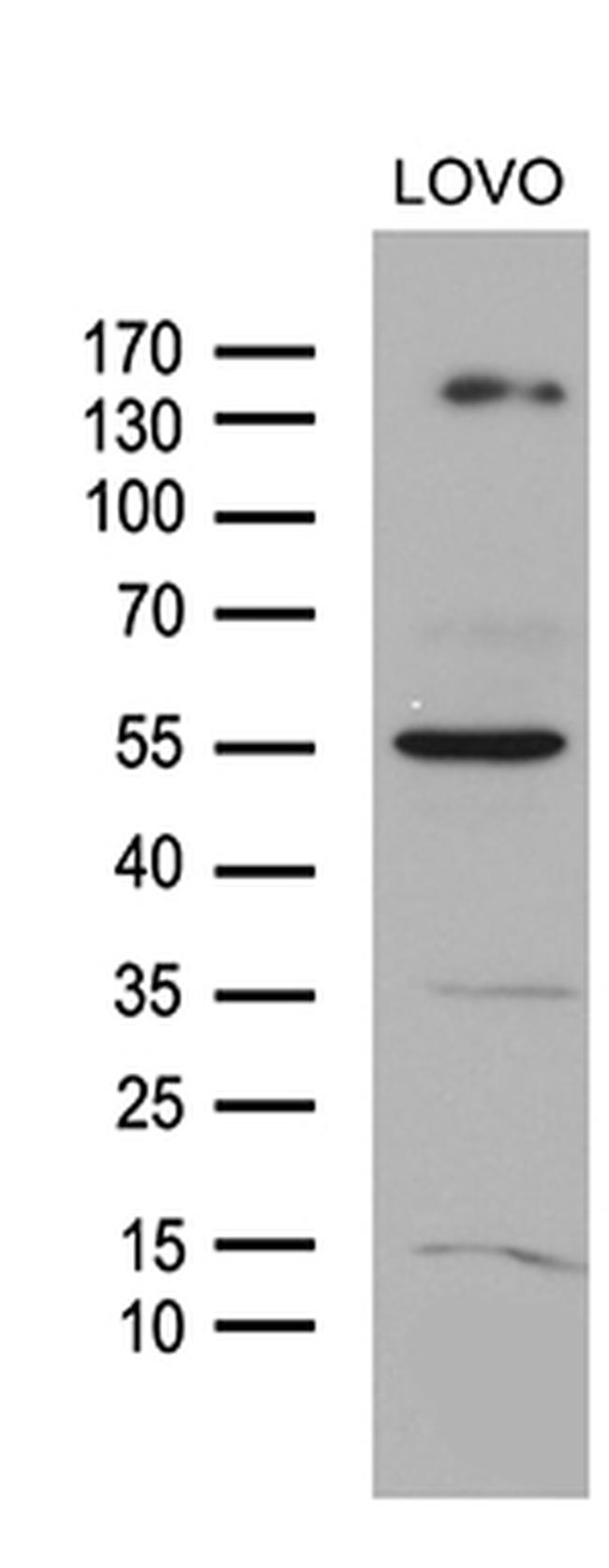 NCOA7 Antibody in Western Blot (WB)