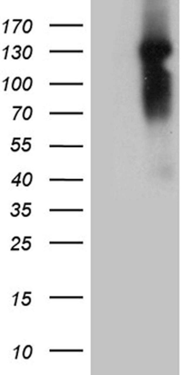 NCOA7 Antibody in Western Blot (WB)