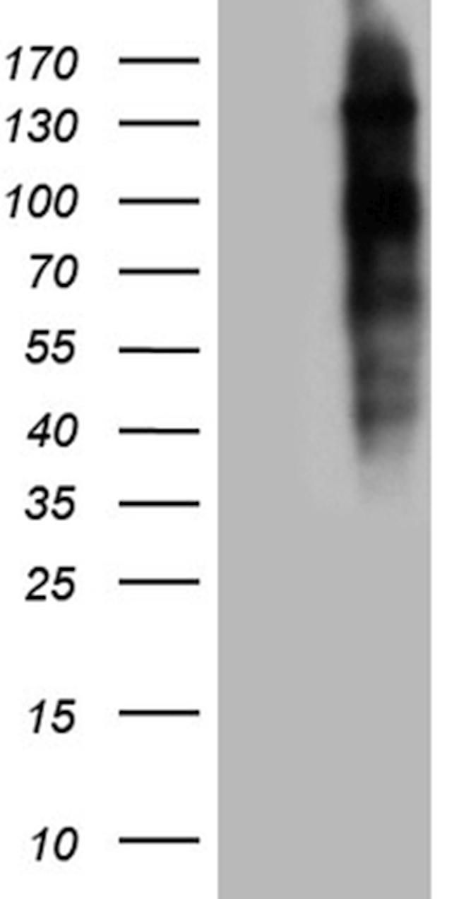 NCOA7 Antibody in Western Blot (WB)