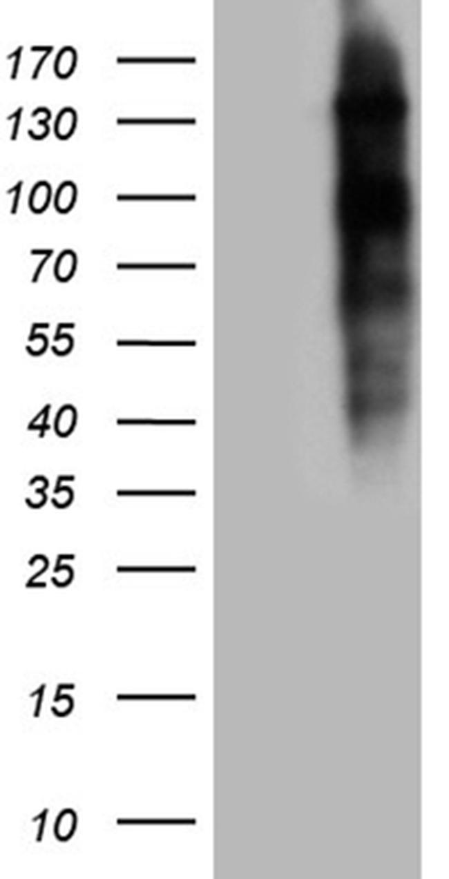 NCOA7 Antibody in Western Blot (WB)