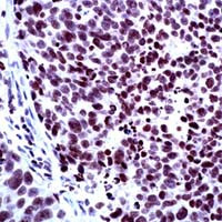 NCoR2 Antibody in Immunohistochemistry (IHC)