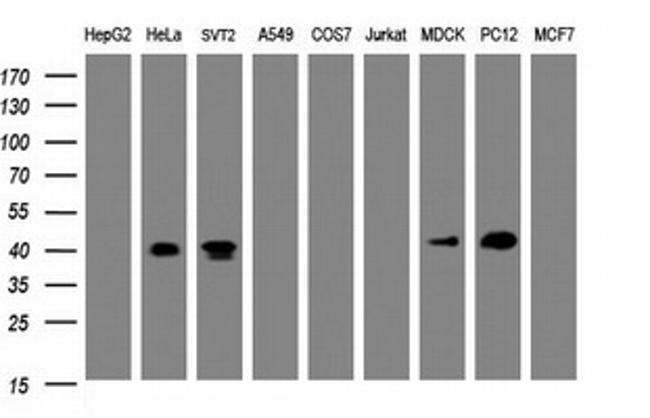 NDEL1 Antibody in Western Blot (WB)