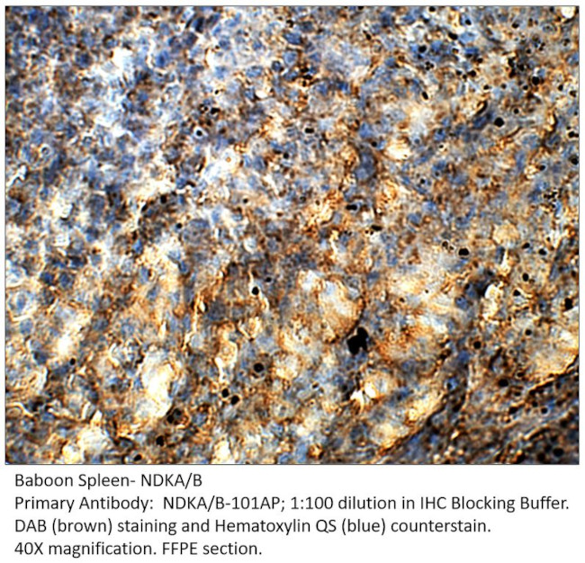 NME2 + NM23A Antibody in Immunohistochemistry (IHC)