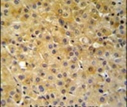 NDUFA10 Antibody in Immunohistochemistry (IHC)