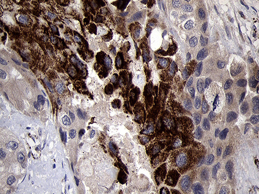 NDUFA4L2 Antibody in Immunohistochemistry (Paraffin) (IHC (P))