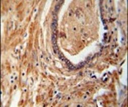 NDUFAF1 Antibody in Immunohistochemistry (IHC)