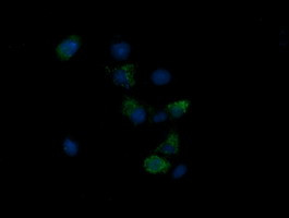 NDUFB10 Antibody in Immunocytochemistry (ICC/IF)