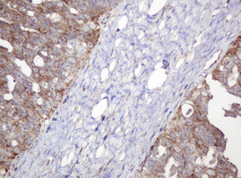NDUFB10 Antibody in Immunohistochemistry (Paraffin) (IHC (P))