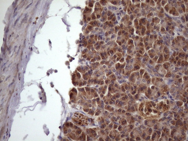NDUFB11 Antibody in Immunohistochemistry (Paraffin) (IHC (P))