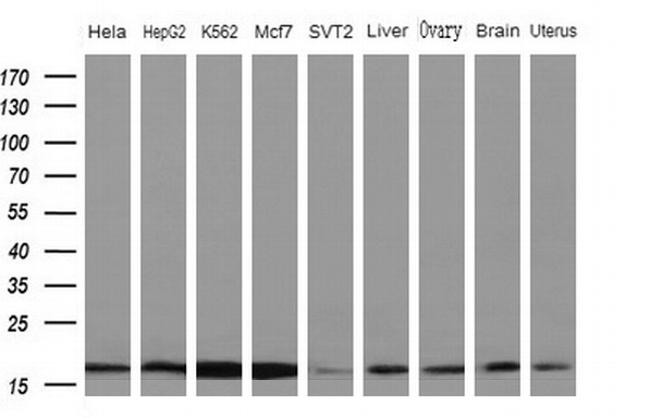 NDUFB11 Antibody in Western Blot (WB)