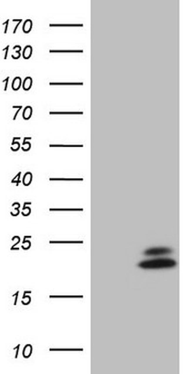 NDUFB11 Antibody in Western Blot (WB)
