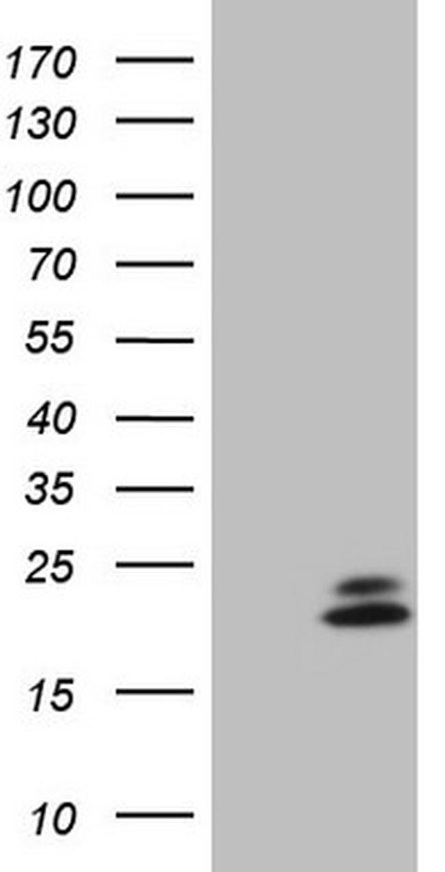 NDUFB11 Antibody in Western Blot (WB)