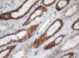 NDUFB9 Antibody in Immunohistochemistry (Paraffin) (IHC (P))