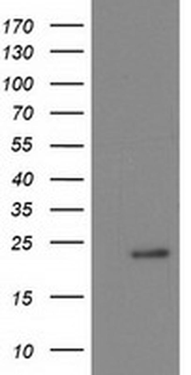 NDUFB9 Antibody in Western Blot (WB)