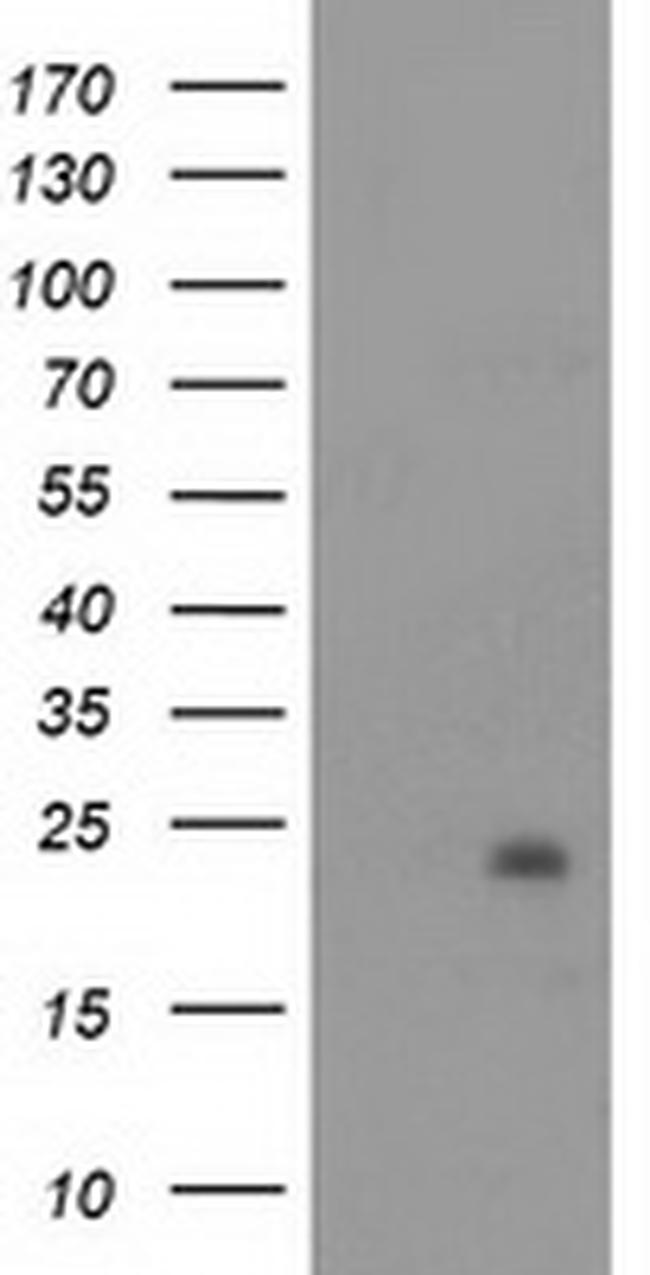 NDUFB9 Antibody in Western Blot (WB)