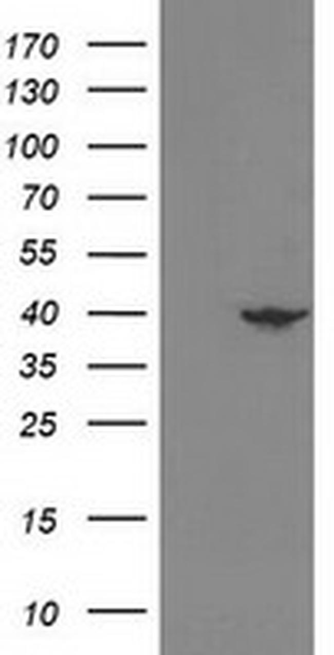 NECAB1 Antibody in Western Blot (WB)