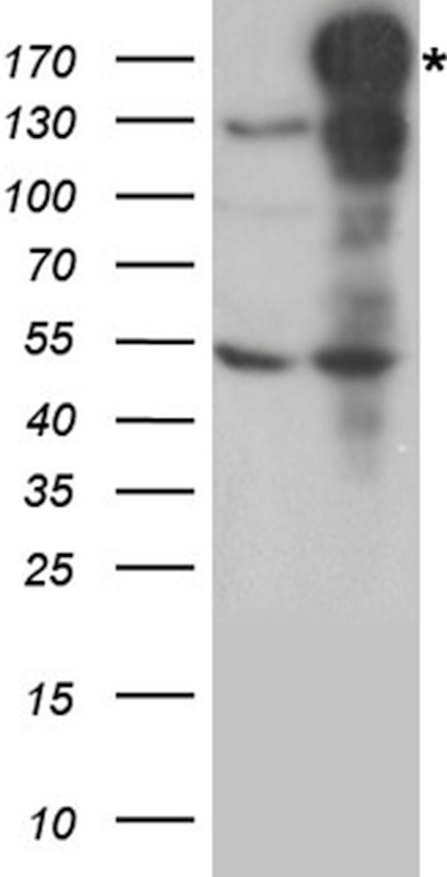 NEDD4 Antibody in Western Blot (WB)