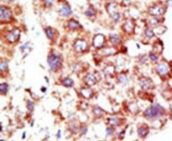 NEDD8 Antibody in Immunohistochemistry (IHC)