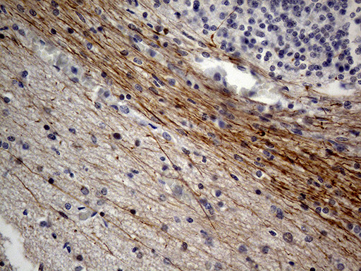 NEFH Antibody in Immunohistochemistry (Paraffin) (IHC (P))