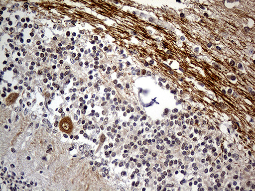 NEFH Antibody in Immunohistochemistry (Paraffin) (IHC (P))