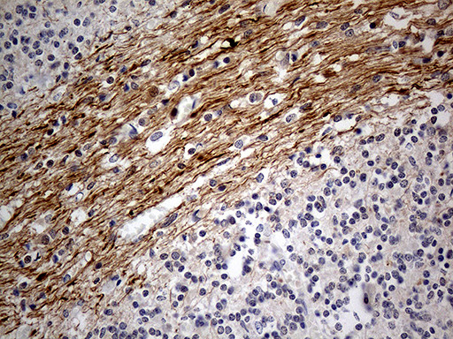 NEFH Antibody in Immunohistochemistry (Paraffin) (IHC (P))