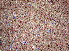 NEFL Antibody in Immunohistochemistry (Paraffin) (IHC (P))